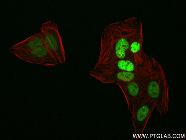 RNGTT Antibody in Immunocytochemistry (ICC/IF)