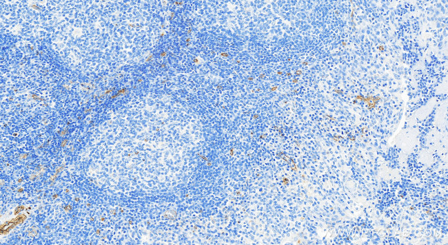 Perforin Antibody in Immunohistochemistry (Paraffin) (IHC (P))