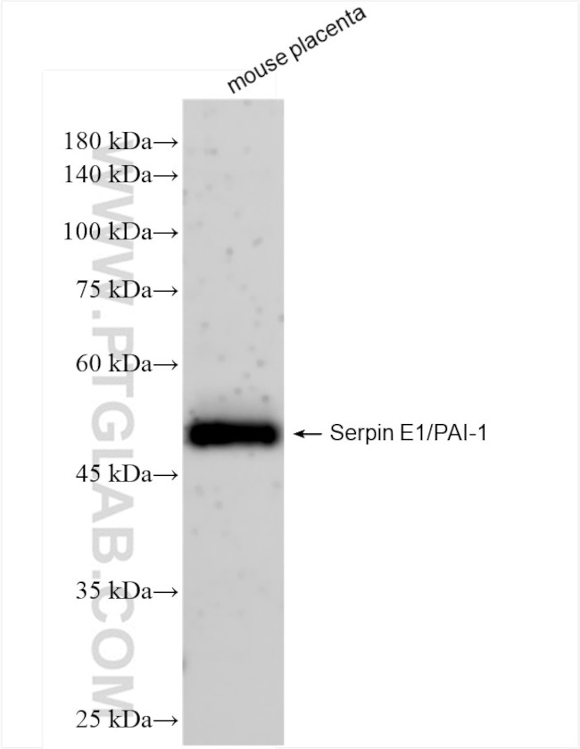 Serpin E1/PAI-1 Antibody in Western Blot (WB)