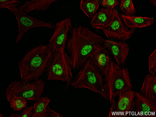 AGXT2L1 Antibody in Immunocytochemistry (ICC/IF)