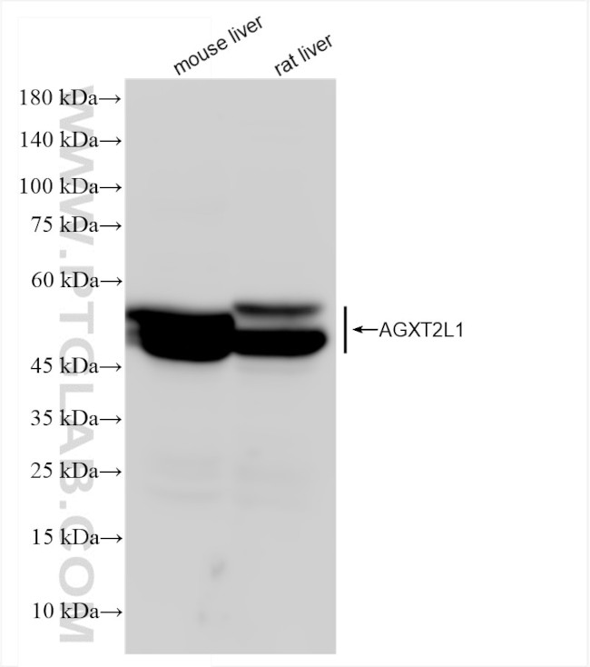 AGXT2L1 Antibody in Western Blot (WB)