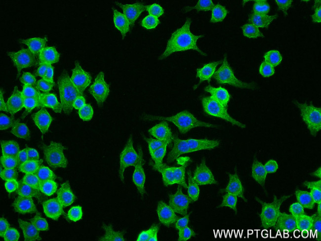 GDF5 Antibody in Immunocytochemistry (ICC/IF)