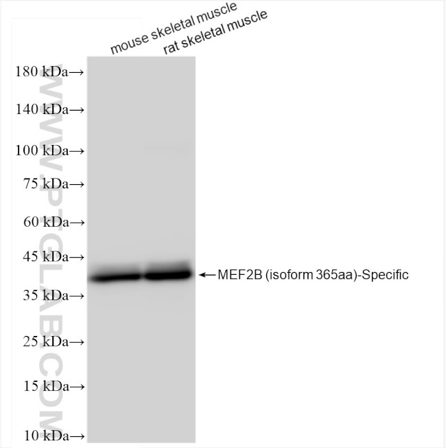 MEF2B Antibody in Western Blot (WB)