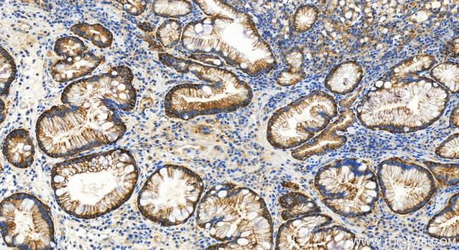 PARP4 Antibody in Immunohistochemistry (Paraffin) (IHC (P))