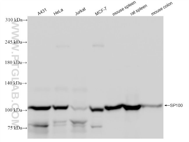 SP100 Antibody in Western Blot (WB)