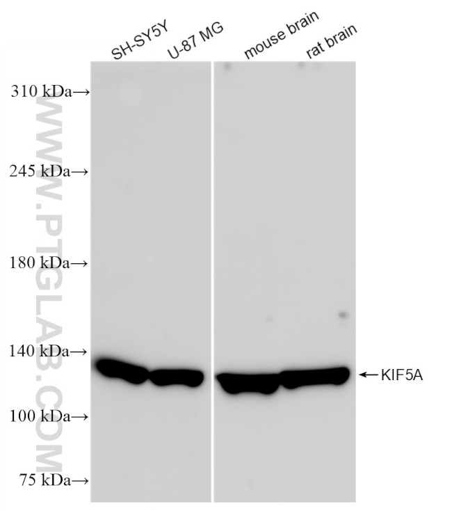 KIF5A Antibody in Western Blot (WB)