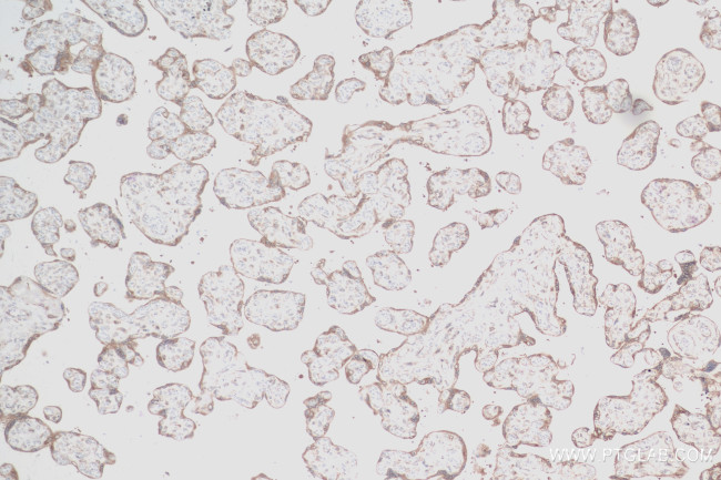 SRP54 Antibody in Immunohistochemistry (Paraffin) (IHC (P))