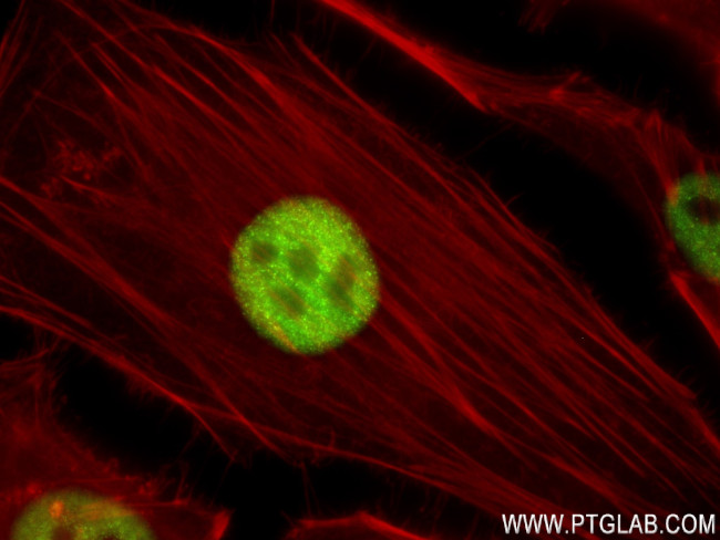 FOXF1 Antibody in Immunocytochemistry (ICC/IF)