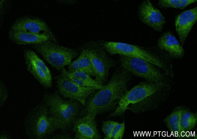 NFKB2, p100 Antibody in Immunocytochemistry (ICC/IF)