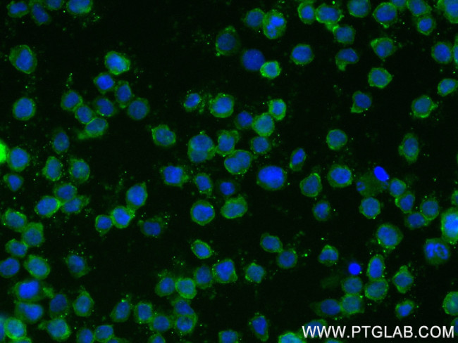 CSF2RA/CD116 Antibody in Immunocytochemistry (ICC/IF)