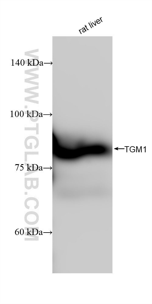TGM1 Antibody in Western Blot (WB)