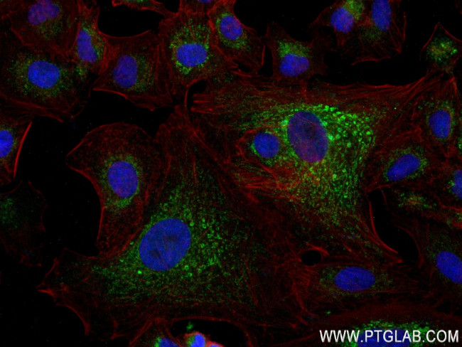ACSF2 Antibody in Immunocytochemistry (ICC/IF)
