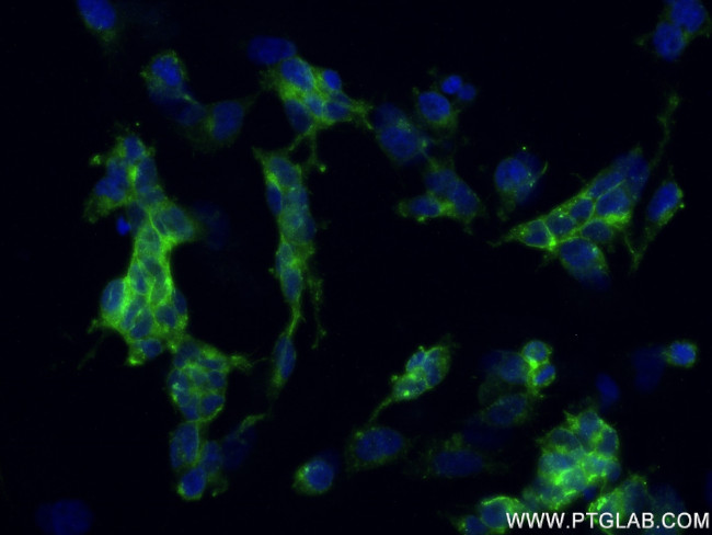 L1CAM Antibody in Immunocytochemistry (ICC/IF)