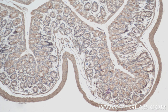 PARP14 Antibody in Immunohistochemistry (Paraffin) (IHC (P))