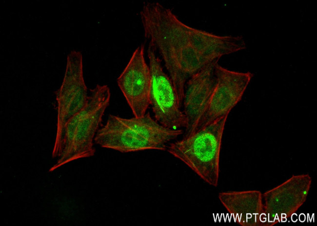 PRC1 Antibody in Immunocytochemistry (ICC/IF)