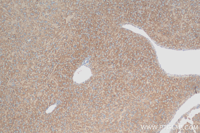 APOB Antibody in Immunohistochemistry (Paraffin) (IHC (P))