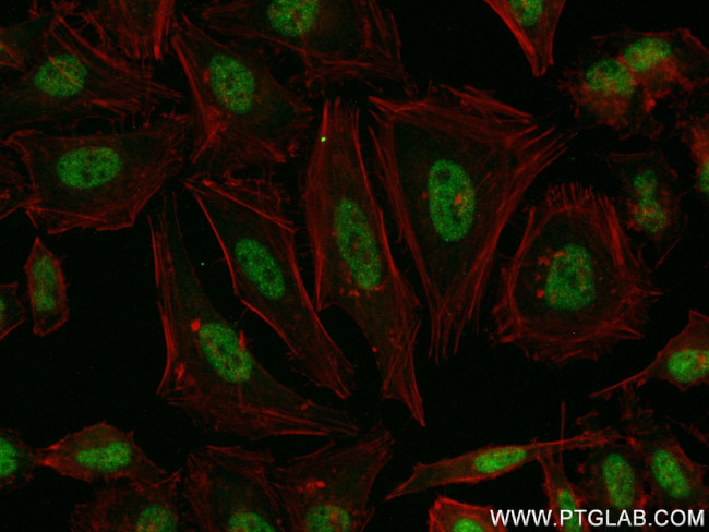 RREB1 Antibody in Immunocytochemistry (ICC/IF)