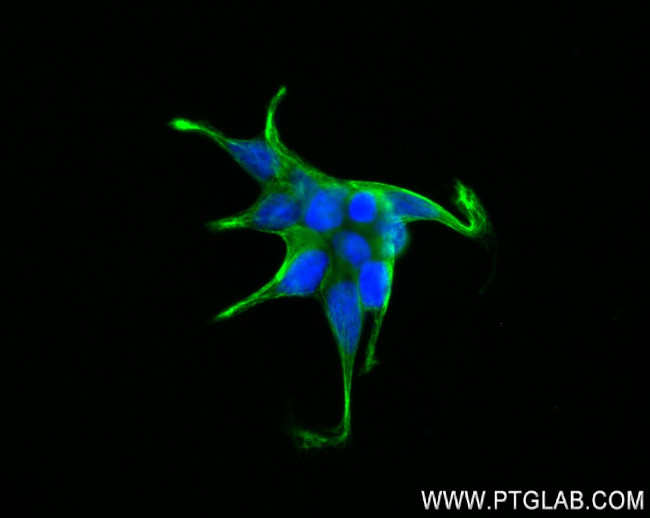 CTNNAL1 Antibody in Immunocytochemistry (ICC/IF)