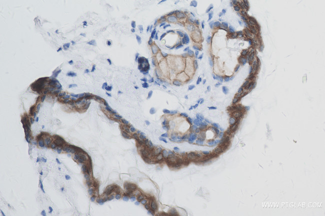 DSG1 Antibody in Immunohistochemistry (Paraffin) (IHC (P))