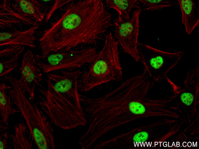 RNF40 Antibody in Immunocytochemistry (ICC/IF)