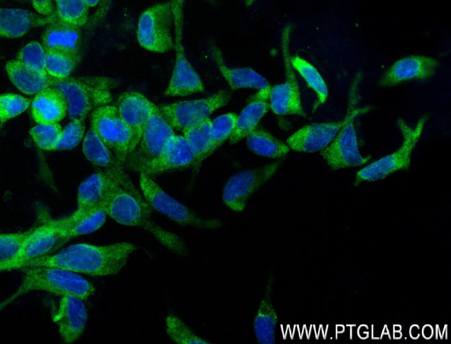 KLK3/PSA Antibody in Immunocytochemistry (ICC/IF)