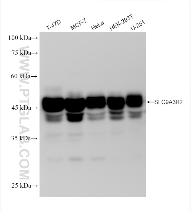 SLC9A3R2 Antibody in Western Blot (WB)