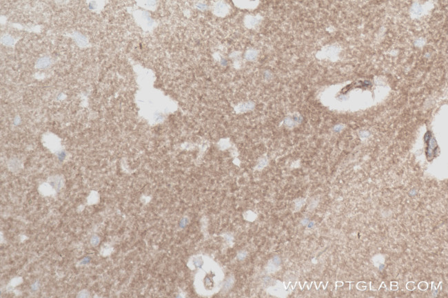 IDO1 Antibody in Immunohistochemistry (Paraffin) (IHC (P))