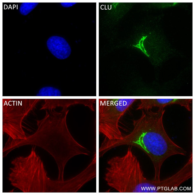Clusterin Antibody in Immunocytochemistry (ICC/IF)