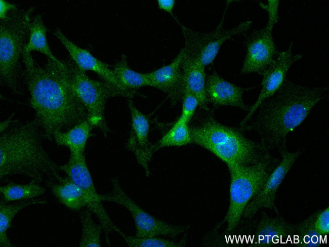 LEP Antibody in Immunocytochemistry (ICC/IF)