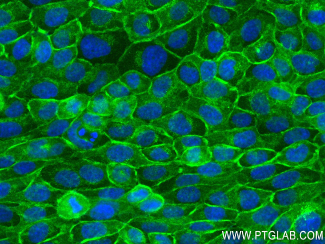 EPCAM/CD326 Antibody in Immunocytochemistry (ICC/IF)