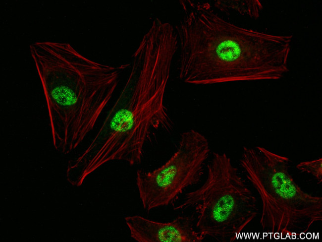 PCF11 Antibody in Immunocytochemistry (ICC/IF)
