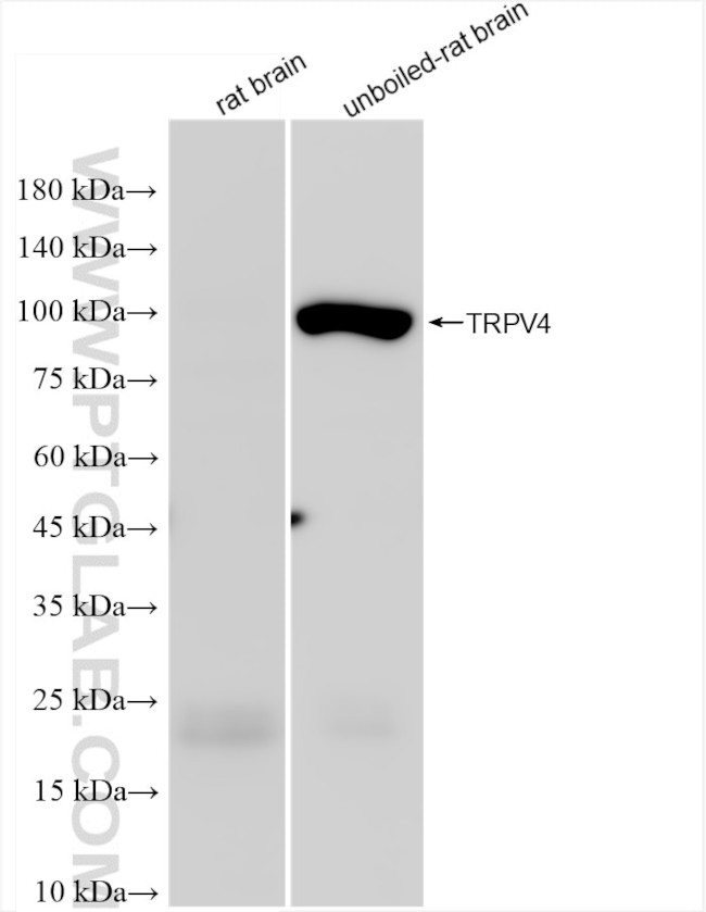 TRPV4 Antibody in Western Blot (WB)