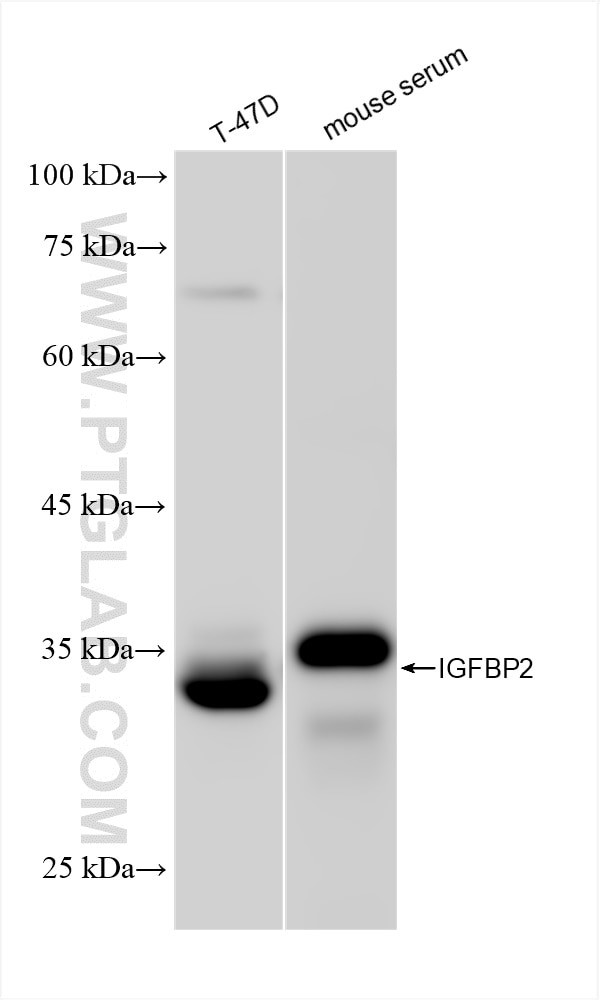 IGFBP2 Antibody in Western Blot (WB)