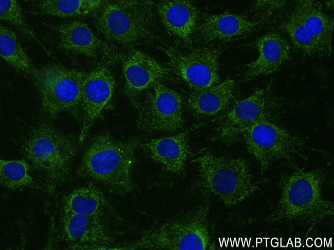 MYH2 Antibody in Immunocytochemistry (ICC/IF)