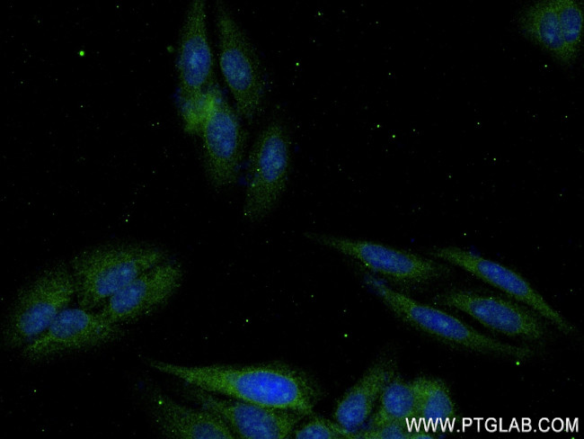 Complement factor B Antibody in Immunocytochemistry (ICC/IF)