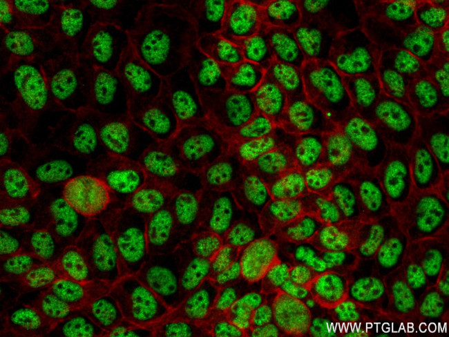 RBM10 Antibody in Immunocytochemistry (ICC/IF)