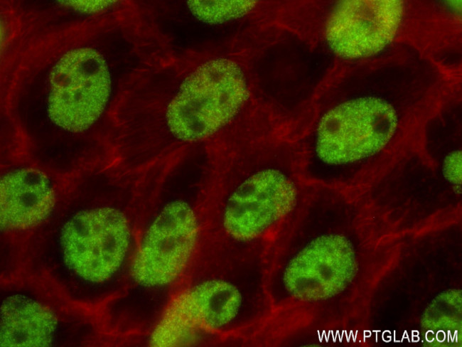 RBM10 Antibody in Immunocytochemistry (ICC/IF)