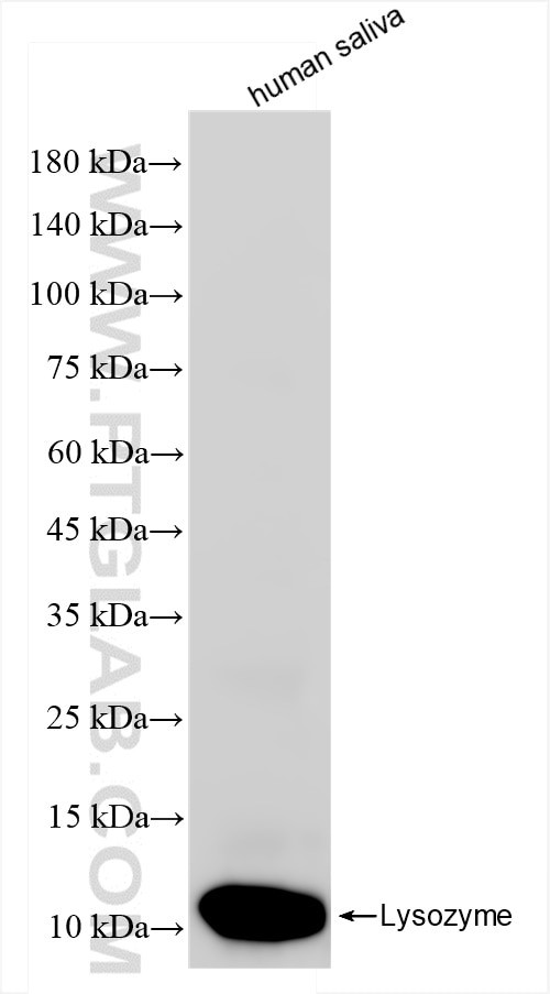 Lysozyme Antibody in Western Blot (WB)