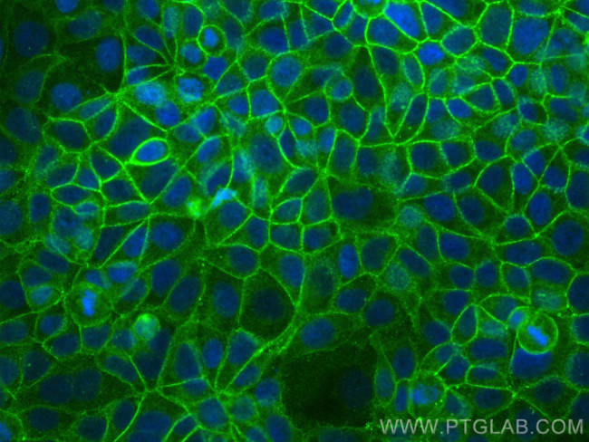 CD9 Antibody in Immunocytochemistry (ICC/IF)