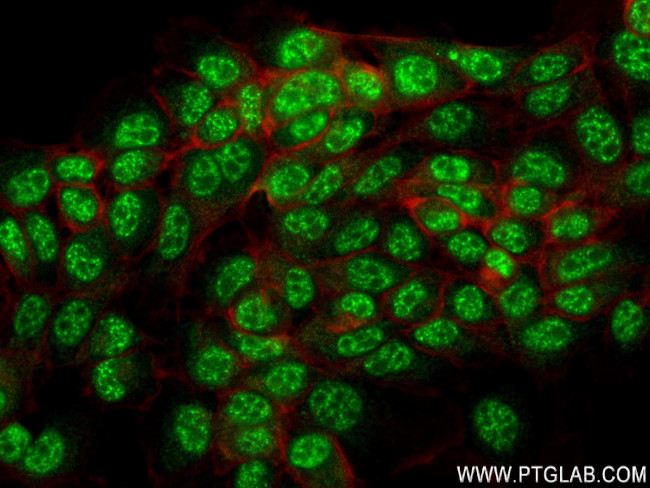IMUP Antibody in Immunocytochemistry (ICC/IF)