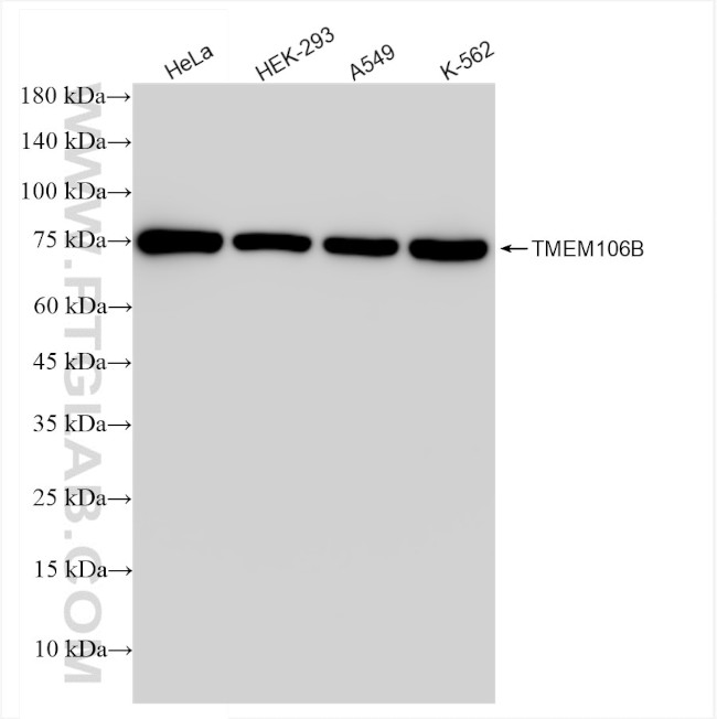TMEM106B Antibody in Western Blot (WB)