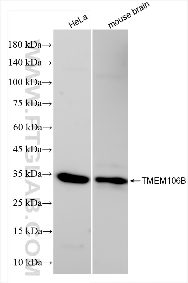 TMEM106B Antibody in Western Blot (WB)