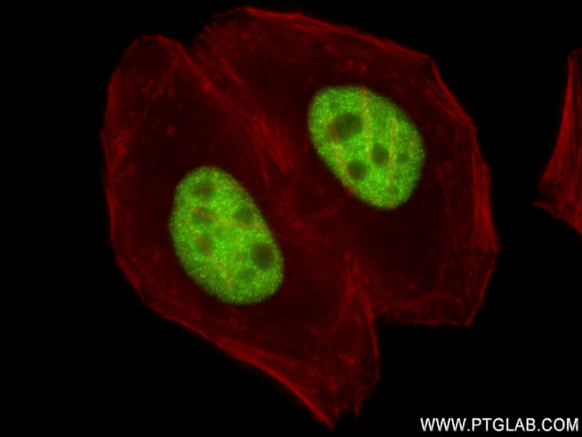ZNF217 Antibody in Immunocytochemistry (ICC/IF)