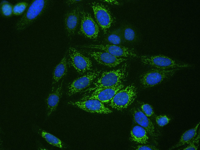 CPS1 Antibody in Immunocytochemistry (ICC/IF)