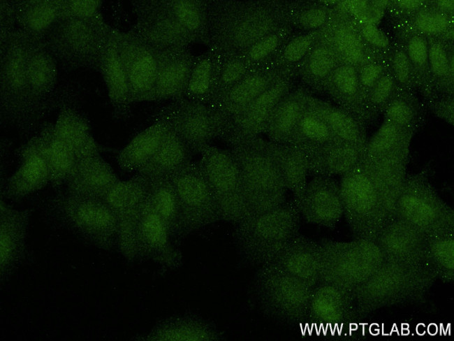 Beta TrCP Antibody in Immunocytochemistry (ICC/IF)