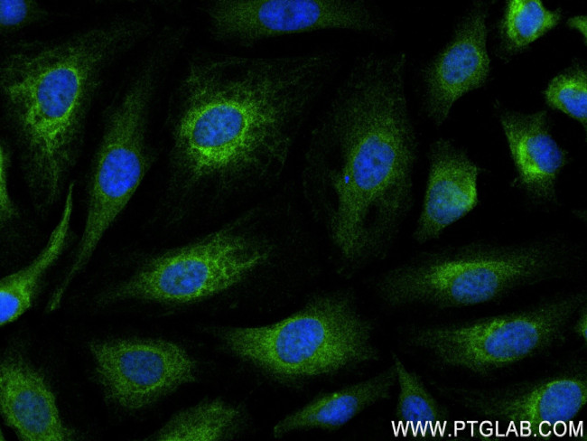 POTEA Antibody in Immunocytochemistry (ICC/IF)