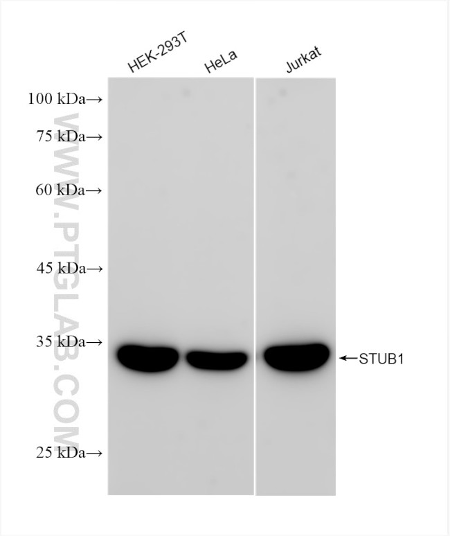 STUB1 Antibody in Western Blot (WB)