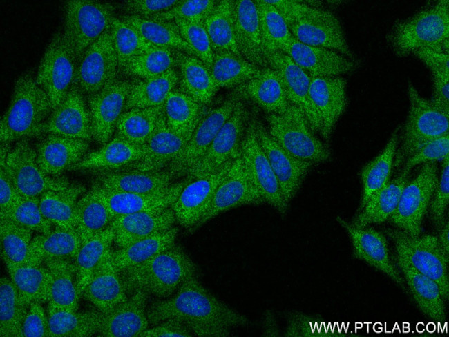 MTMR4 Antibody in Immunocytochemistry (ICC/IF)