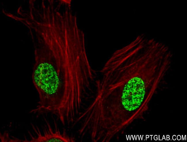 Di/Tri-Methyl-Histone H3 (Lys36) Antibody in Immunocytochemistry (ICC/IF)