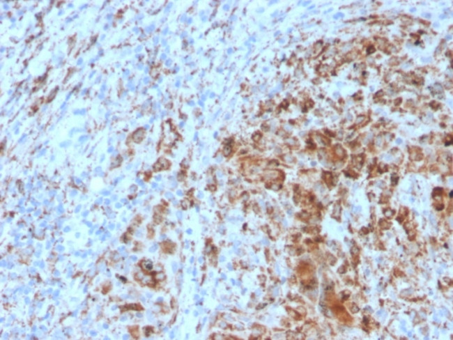 TIM3/HAVCR2/CD366 (Effector T-Cell Marker) Antibody in Immunohistochemistry (Paraffin) (IHC (P))
